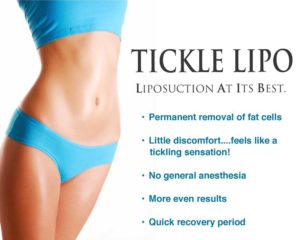tickle-lipo-website